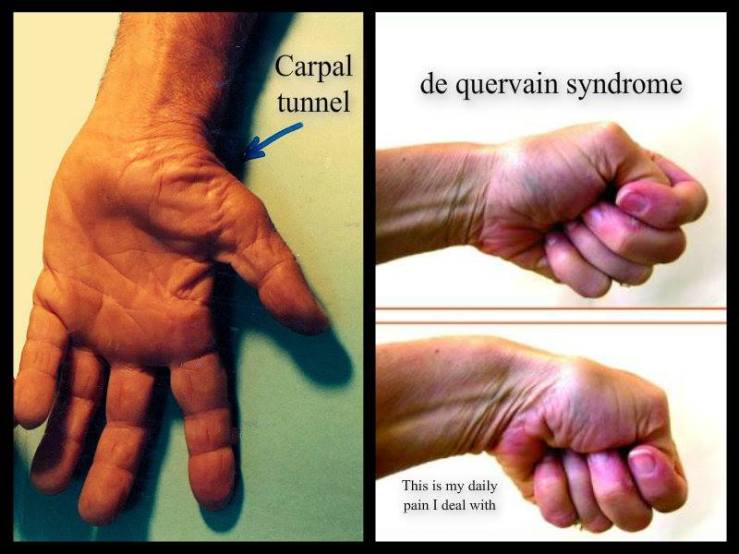 531942_10201570139871704_230385320_n