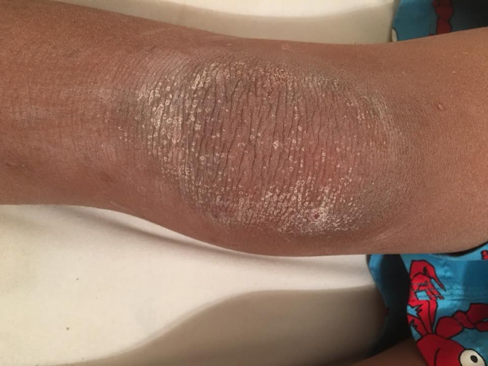 22308949_10213456387580468_4133234866811822841_n