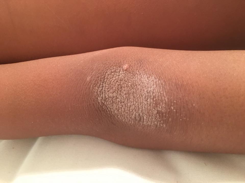 22310381_10213456388740497_5473812094962072977_n