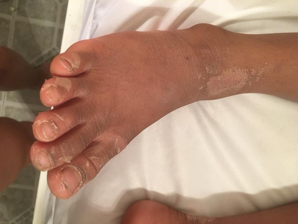 22310429_10213456387300461_7470060238019376057_n