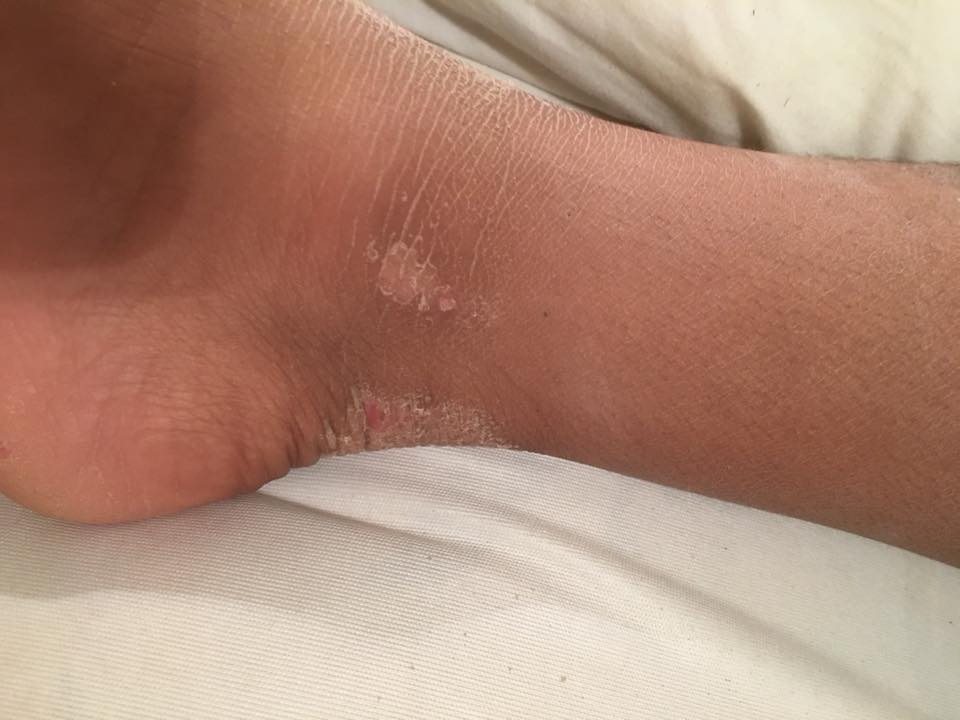 22310523_10213456387980478_3807872183220412928_n