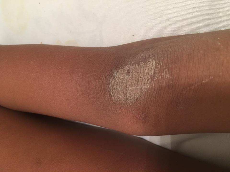 22406092_10213456389100506_2324803622931984810_n